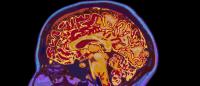 Brain Scan Image